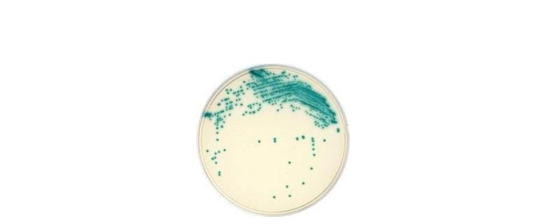 微生物培养基质有哪些种类,成分一般包括什么